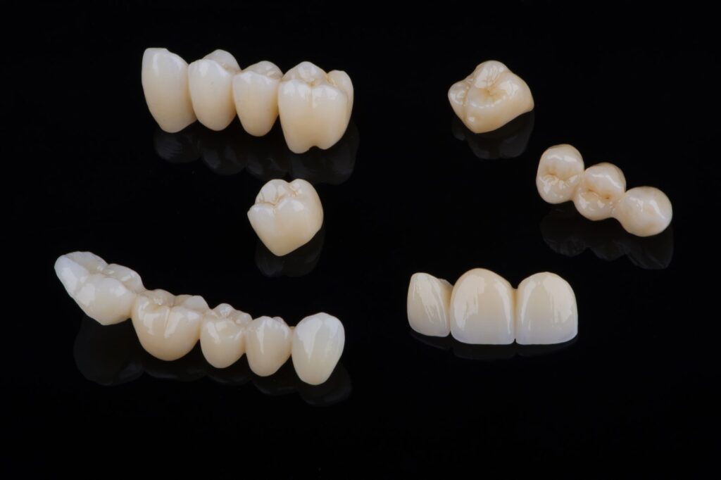Coronas y puentes de zirconia de alta estética
